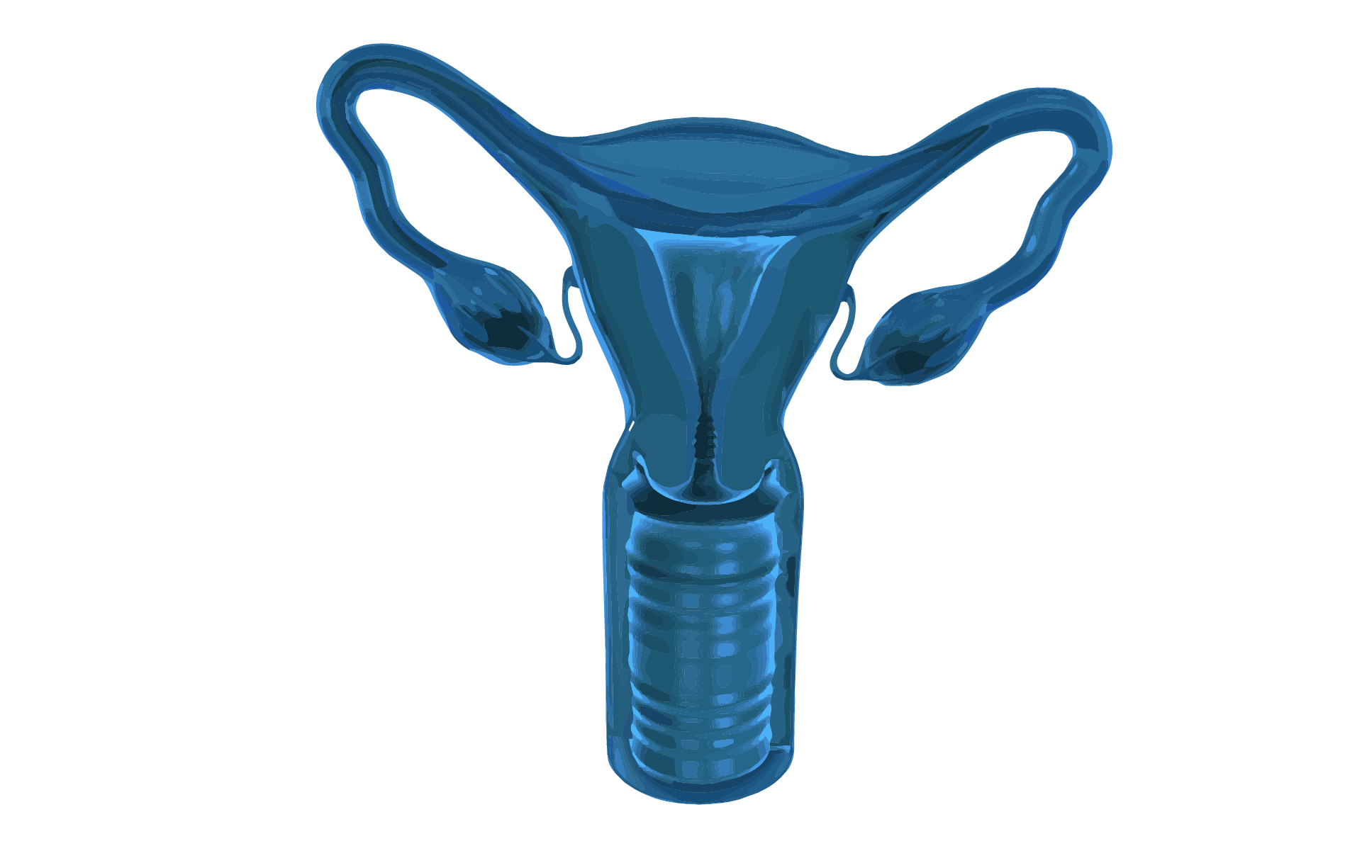 A 3D graphic image of the human female reproductive system