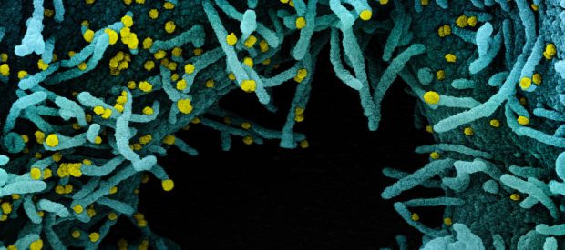 Colorized scanning electron micrograph of a cell heavily infected with SARS-CoV-2 virus particles (yellow), isolated from a patient sample. The black area in the image is extracellular space between the cells.