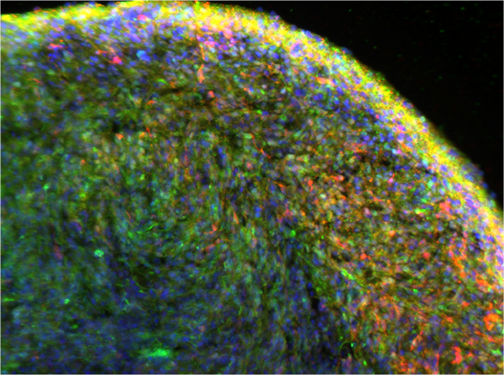 Photo of 3-D midbrain organoid.