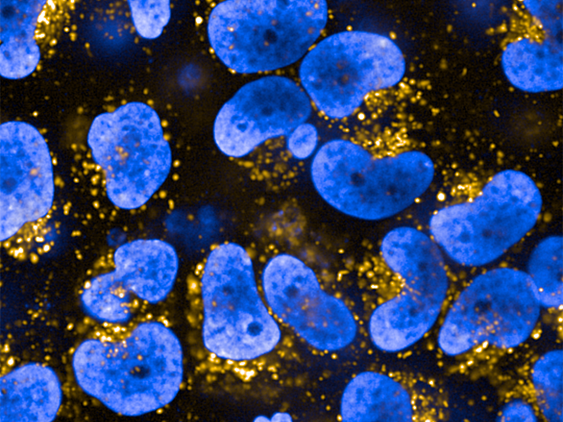 Image shows yellow lysosomes and blue cells.