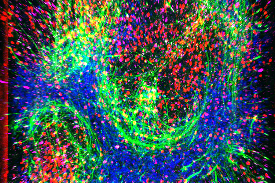 Microscopic image of motor neurons and axons in an ALS organ chip.