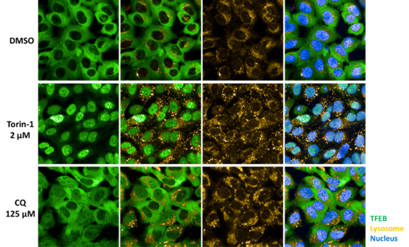 High-content, high-throughput (1,536-well) assay to identify compounds modulating the autophagy pathway
