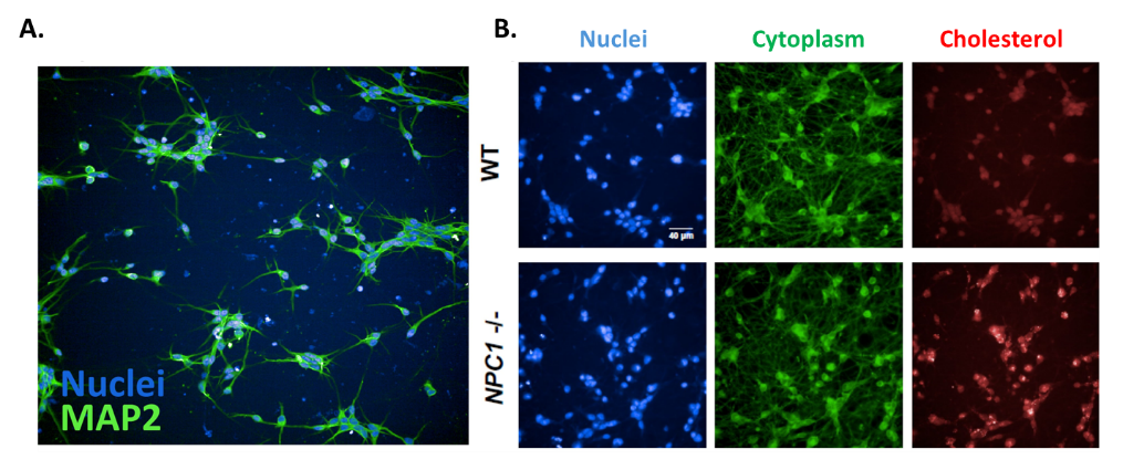 High-throughput small molecule screening to identify inhibitors of unesterified cholesterol accumulation in NPC1-deficient neurons