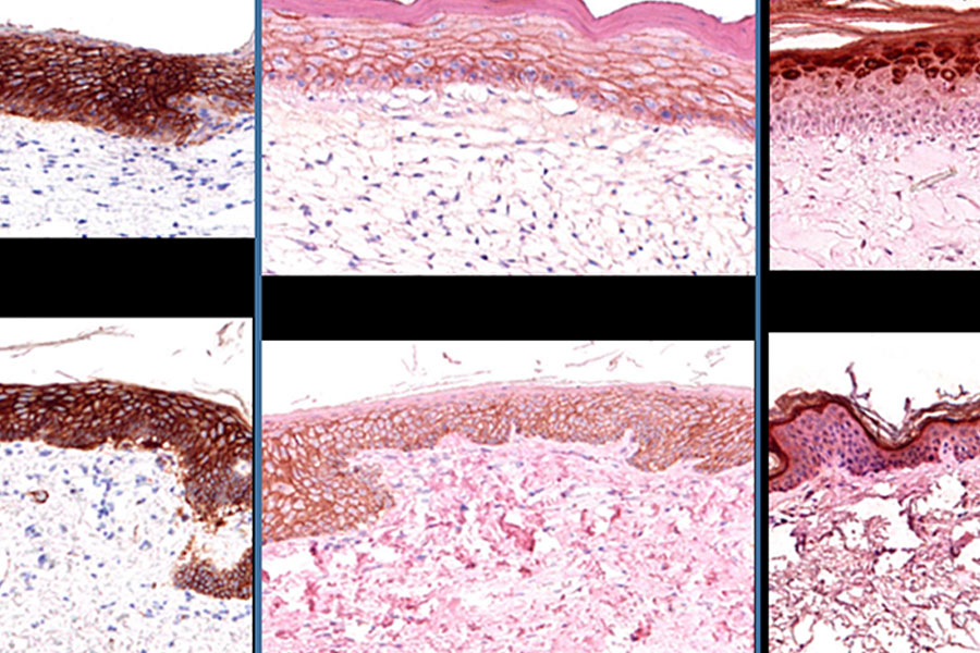 Histology is the gold standard to determine the architecture of tissues.   These panels showing histological images of 3-D Bioprinted skin (top row) and native skin (bottom row) staining for different markers relevant to skin cells and extracellular matrix composition. Image by Paige Derr and Kristy Derr, NCATS.