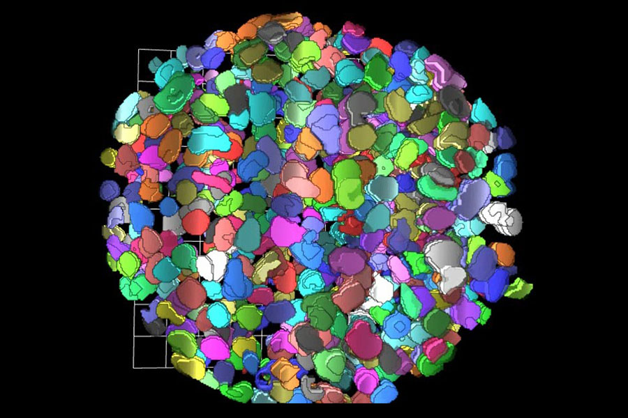 Computed 3-D rendition of a the cells in a tumor sphere model after applying a clearing protocol that enables measurements of fluorescence signal from cell nuclei stained with a fluorescent dye, deep inside the tissues.