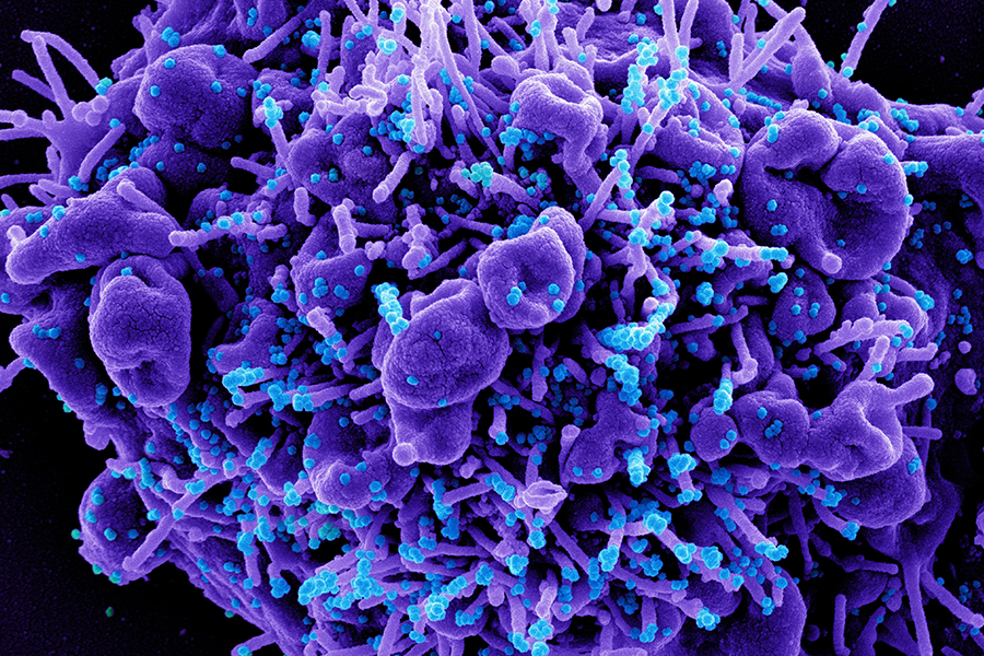 Colorized scanning electron micrograph of an apoptotic cell (purple) infected with SARS-COV-2 virus particles (blue), isolated from a patient sample.