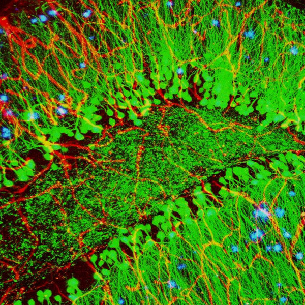 Microscopic image of a mouse brain showing blood vessels, nerve cells and the plaques that are associated with Alzheimer’s disease.