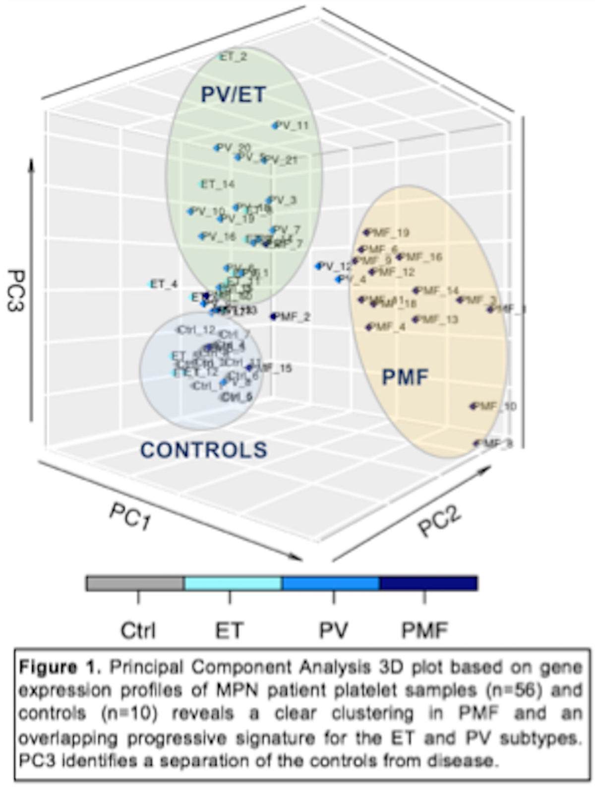 Figure1. Principal Component Analysis 3D plot based on gene expression profiles of MPN patient samples (n=56) and controls (n=10) reveals a clear clustering in PMF and an overlapping progressive signature for the ET and PV subtypes. PC3 identifies a separation of the controls from disease.