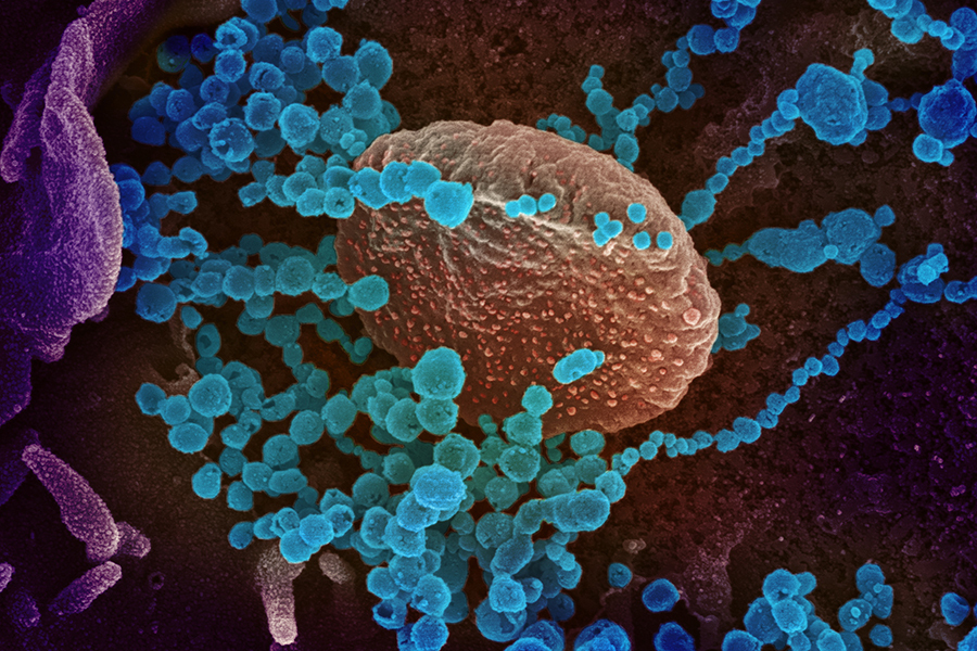 This scanning electron microscope image shows SARS-CoV-2 (round blue objects) emerging from the surface of cells cultured in the lab. SARS-CoV-2, also known as 2019-nCoV, is the virus that causes COVID-19. The virus shown was isolated from a patient in the U.S. Image captured and colorized at NIAID's Rocky Mountain Laboratories (RML) in Hamilton, Montana. (NIAID)