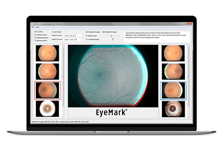 A laptop shows images from EyeMark.