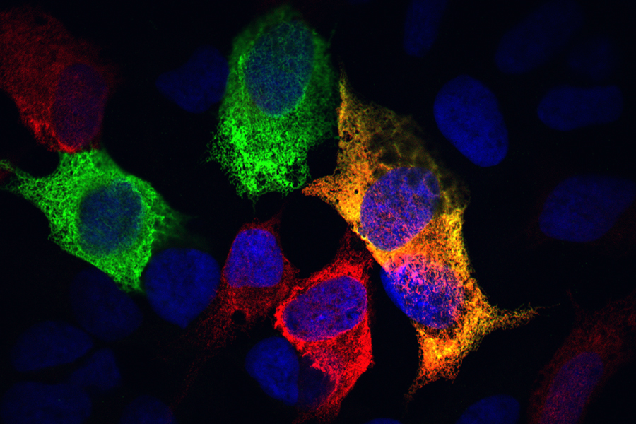 Endoplasmic reticulum proteins in human cells lit up in green, red and yellow using fluorescent technology.