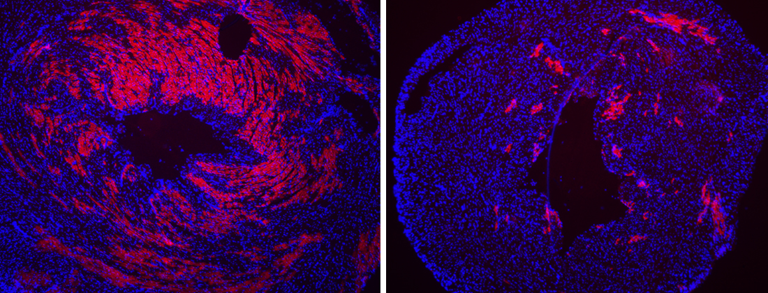 Treatment with a compound prevents heart damage in a mouse with muscular dystrophy.