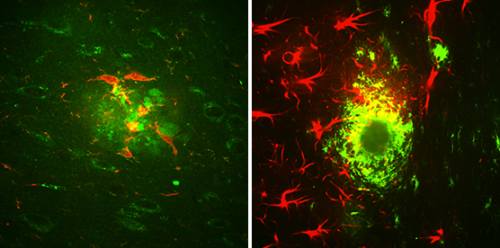 Microglia and astrocytes surround amyloid beta clusters located in the brain of a mouse. 