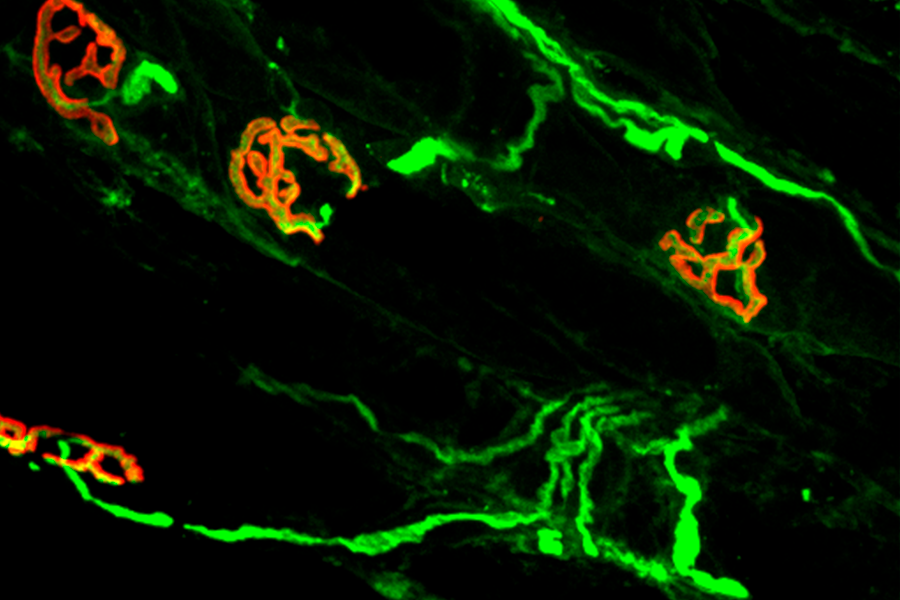 Motor nerves send signals to muscles at neuromuscular junctions.