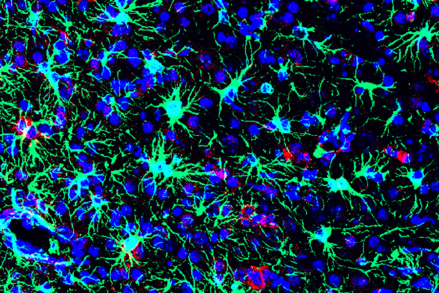 Picture of Zika-infected mouse brain from NIH study that looked for effective anti-viral treatments.