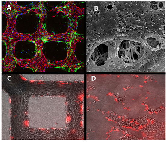 In the top left image (A), tiny human blood vessels were placed on a device that mimics the environment inside the human kidney. The microvessel tissue, which is red, lined up as it was supposed to, next to the green support cells. The top right image (B) shows an extreme close-up of the blood vessels with tiny holes that allow molecules to pass in and out — a characteristic of blood vessels in the kidneys. In the bottom left image (C), fluid flows through the vessels. When scientists add a drug that causes clotting, the red blood cells and platelets attach to the vessels (D), similarly to microvessels within the body.