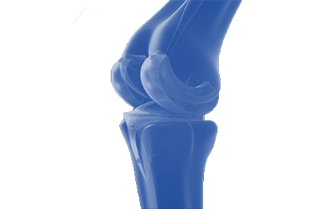 A 3D graphic image of the human joints