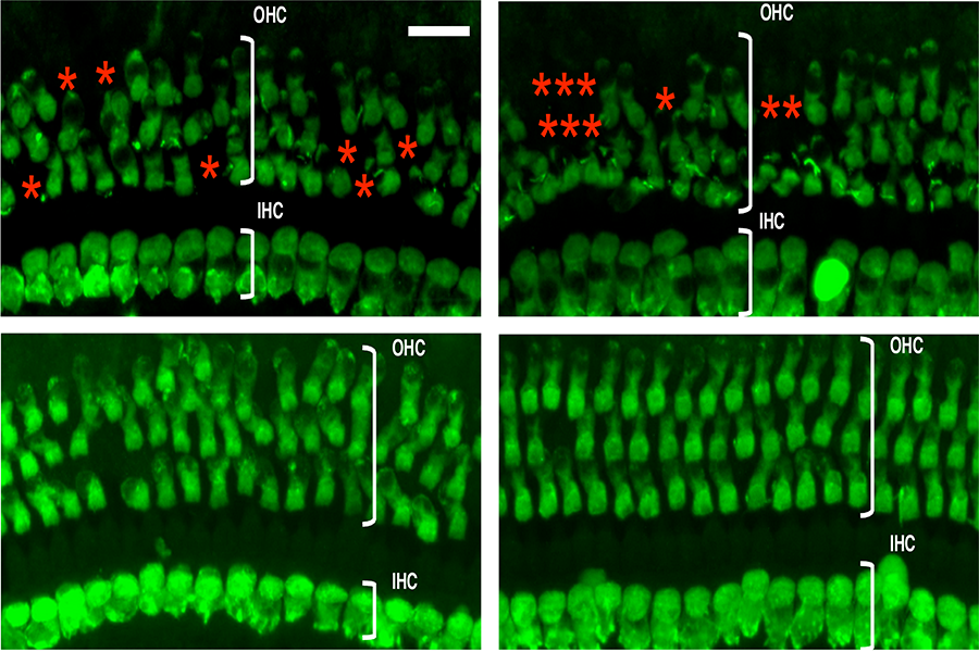 Cells in the mouse ear with and without treatment.