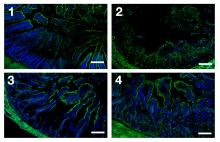 Confocal microscopy images show cell damage.
