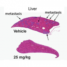 liver image